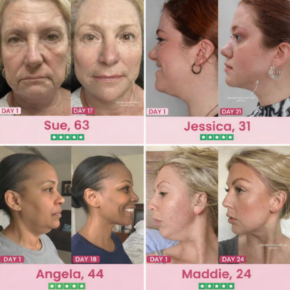 Mascarilla Lifting de Colágeno para Mentón | Varen – Reafirma tu Piel